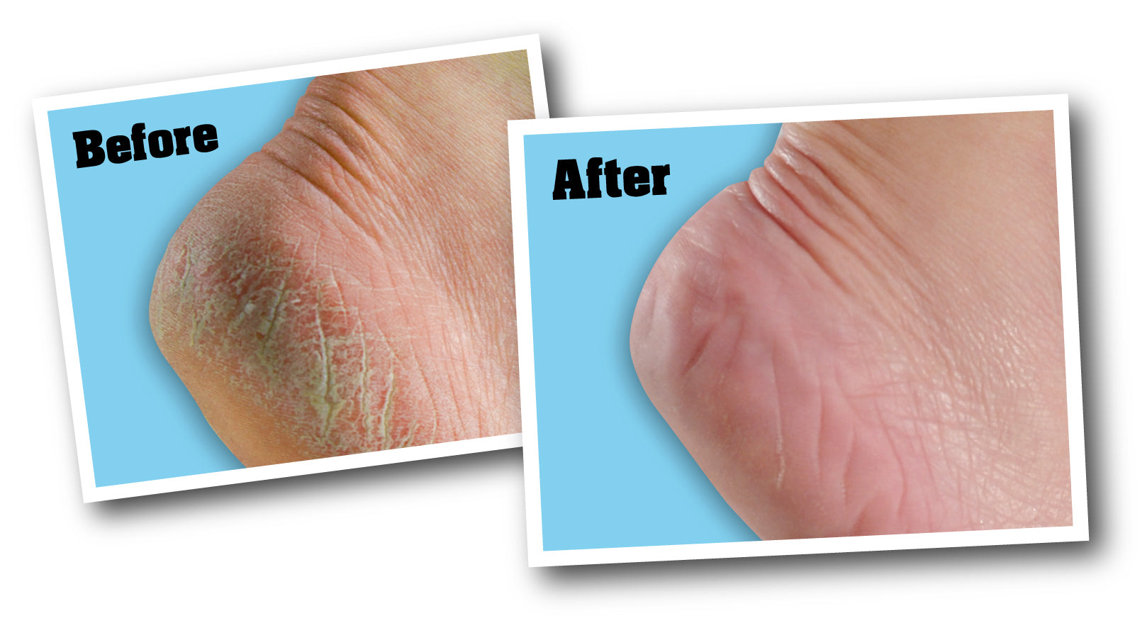 O'Keeffe's For Healthy Feet Foot Cream 3oz